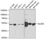 GluD2 Antibody in Western Blot (WB)