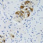 HYOU1 Antibody in Immunohistochemistry (Paraffin) (IHC (P))