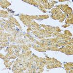 IL-20 Antibody in Immunohistochemistry (Paraffin) (IHC (P))