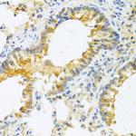 IL-20 Antibody in Immunohistochemistry (Paraffin) (IHC (P))