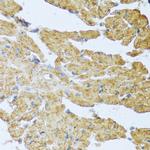 IL-20 Antibody in Immunohistochemistry (Paraffin) (IHC (P))