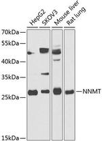 NNMT Antibody in Western Blot (WB)