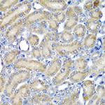 PDCD6 Antibody in Immunohistochemistry (Paraffin) (IHC (P))