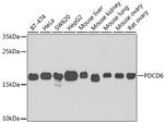 PDCD6 Antibody in Western Blot (WB)