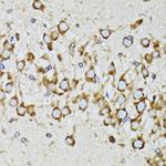 Ribophorin I Antibody in Immunohistochemistry (Paraffin) (IHC (P))