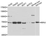 Ribophorin I Antibody in Western Blot (WB)