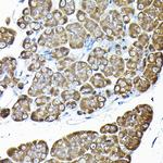 RPS14 Antibody in Immunohistochemistry (Paraffin) (IHC (P))