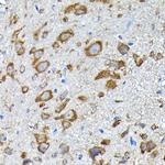 RPS14 Antibody in Immunohistochemistry (Paraffin) (IHC (P))