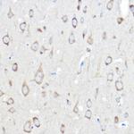 Seryl-tRNA synthetase Antibody in Immunohistochemistry (Paraffin) (IHC (P))