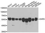 Seryl-tRNA synthetase Antibody in Western Blot (WB)