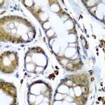 SBP2 Antibody in Immunohistochemistry (Paraffin) (IHC (P))