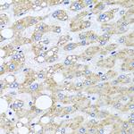 Sorcin Antibody in Immunohistochemistry (Paraffin) (IHC (P))