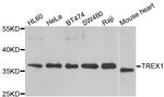 TREX1 Antibody in Western Blot (WB)