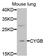 Cytoglobin Antibody in Immunocytochemistry (ICC/IF)