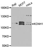 KCNH1 Antibody in Western Blot (WB)