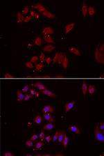 NPHP1 Antibody in Immunocytochemistry (ICC/IF)