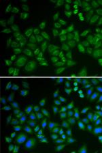 ASM Antibody in Immunocytochemistry (ICC/IF)