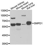 ASM Antibody in Western Blot (WB)