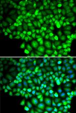 ALOX15B Antibody in Immunocytochemistry (ICC/IF)