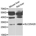 SLC25A20 Antibody in Western Blot (WB)