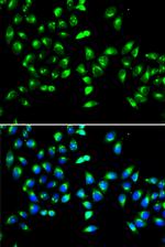 GALNT2 Antibody in Immunocytochemistry (ICC/IF)