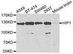 HIP1 Antibody in Western Blot (WB)