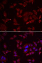 PFKFB3 Antibody in Immunocytochemistry (ICC/IF)