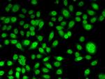 Periplakin Antibody in Immunocytochemistry (ICC/IF)