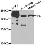 Periplakin Antibody in Western Blot (WB)