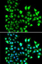 SNRPD2 Antibody in Immunocytochemistry (ICC/IF)