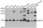 SNRPD2 Antibody in Western Blot (WB)