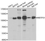 MBTPS1 Antibody in Western Blot (WB)