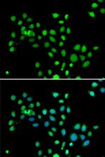 Histone Macro-H2A.1 Antibody in Immunocytochemistry (ICC/IF)