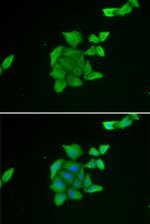 TUSC2 Antibody in Immunocytochemistry (ICC/IF)