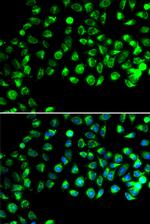 GTL3 Antibody in Immunocytochemistry (ICC/IF)