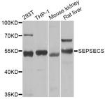 SLA/LP Antibody in Western Blot (WB)