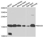 NAA20 Antibody in Western Blot (WB)