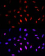 COMMD1 Antibody in Immunocytochemistry (ICC/IF)