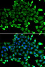 COMMD1 Antibody in Immunocytochemistry (ICC/IF)