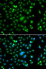 ELF5 Antibody in Immunocytochemistry (ICC/IF)