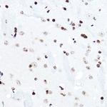 ELF5 Antibody in Immunohistochemistry (Paraffin) (IHC (P))