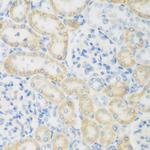 NAT8B Antibody in Immunohistochemistry (Paraffin) (IHC (P))