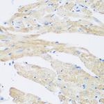 NAT8B Antibody in Immunohistochemistry (Paraffin) (IHC (P))