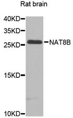 NAT8B Antibody in Western Blot (WB)