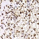 PHIP Antibody in Immunohistochemistry (Paraffin) (IHC (P))