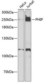 PHIP Antibody in Western Blot (WB)