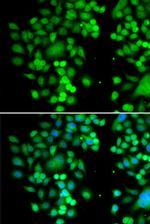 PHYHD1 Antibody in Immunocytochemistry (ICC/IF)