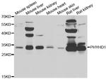 PHYHD1 Antibody in Western Blot (WB)