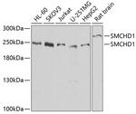 SMCHD1 Antibody in Western Blot (WB)