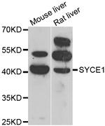 SYCE1 Antibody in Western Blot (WB)